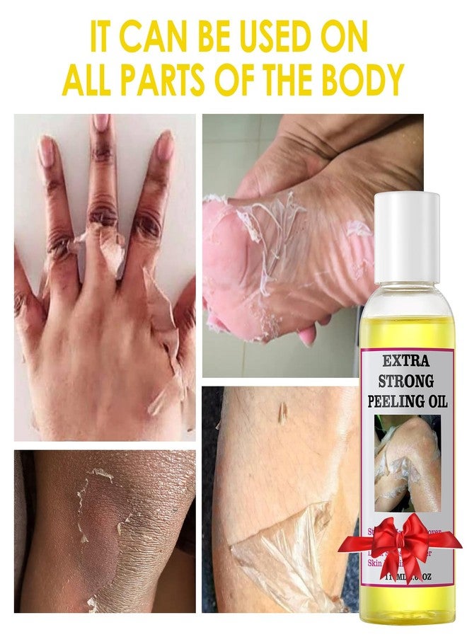 YAFUSIPE Yellow Peeling Oil for Dark Skin Strong Peel Oil Extra Strength Exfoliating Chemical Exfoliant Peels Solution at Home Body Peeling for Exfoliate Body Hand Foot Knuckle All Skin Type 3.66 OZ - Image 2